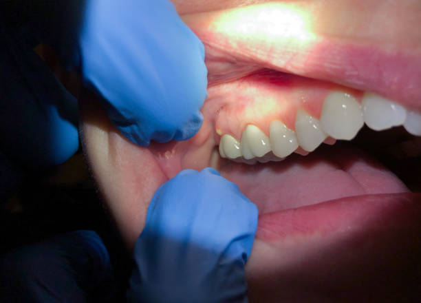 Best Emergency TMJ Treatment in Rendon, TX